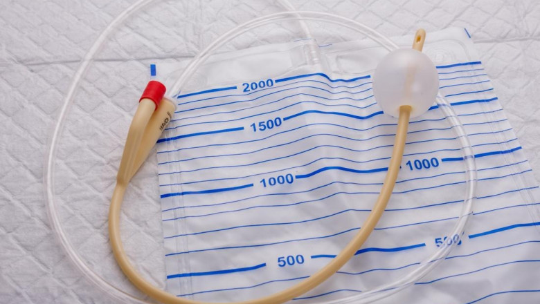 Report on Cost Requirements for Setting Up a Catheter Manufacturing Plant