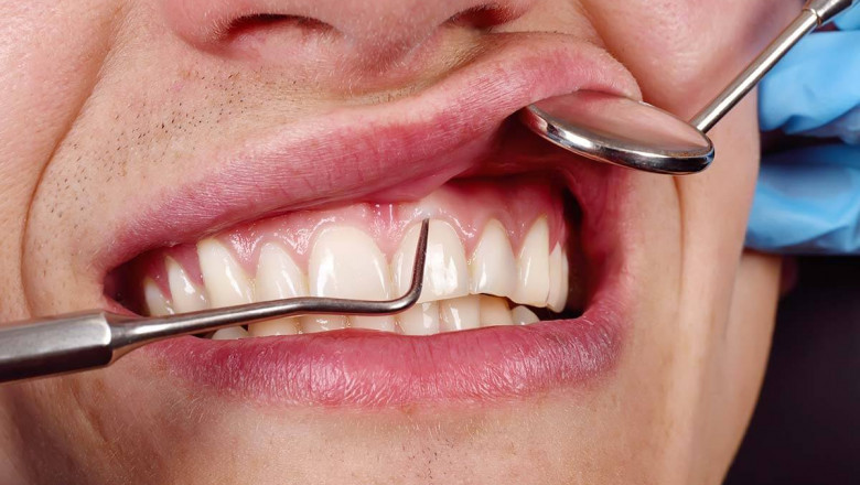 Advanced Periodontal Solutions: Safeguarding Healthy Gums