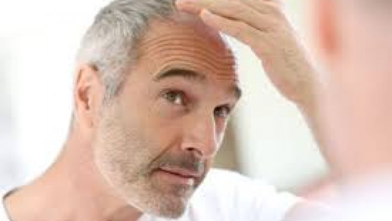 Hair Restoration in Torrance: The Best Clinics for Thicker, Fuller Hair
