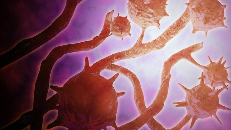 Histoplasmosis Treatment Market to Surge with Antifungal Nanotechnology