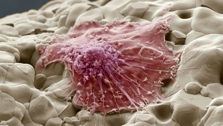 Human Osteoblasts Market to Surge Due to Rising Bone Regenerative Research