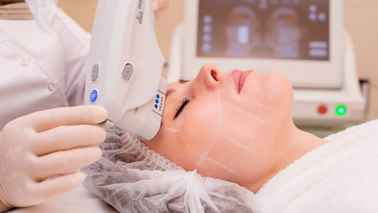 Is HIFU Treatment in Islamabad Worth the Price? I