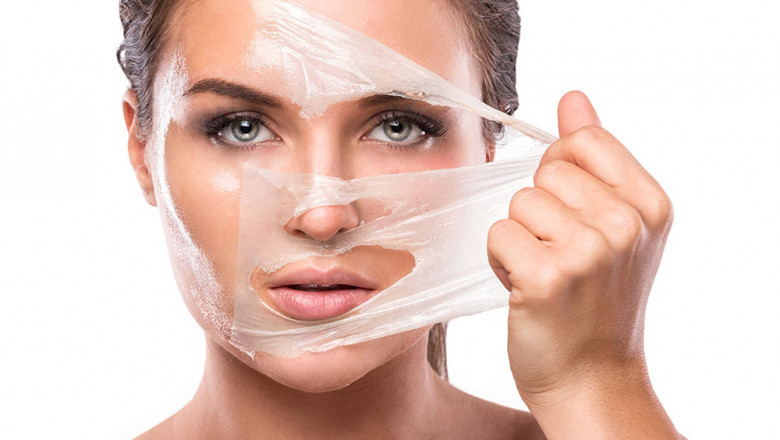 Post-Chemical Peel Care: Tips for Faster Healing