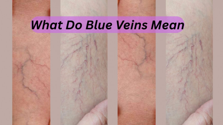 What Do Blue Veins Mean?