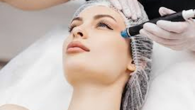 Dubai's Secret to Glowing Skin: PRP Microneedling in Dubai UAE