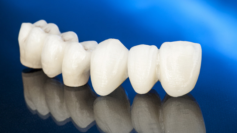 How To Find Reliable Emergency Dental Care In Timonium Fast