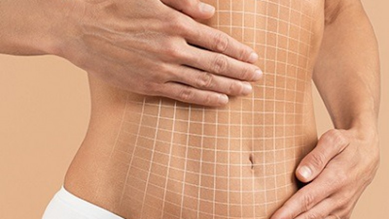 Tummy Tuck Dubai: What Are the Signs That You Might Be Ready for a Tummy Tuck
