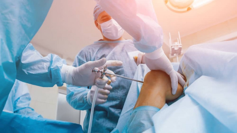 Arthroscopy Surgery Delhi: Quick Recovery and Minimal Pain for Joint Problems