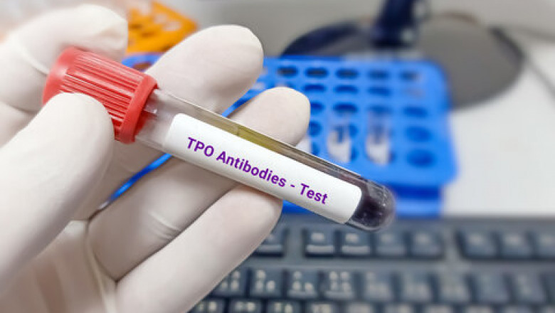 Autoimmune Disease Diagnostics Market Size Scope and Demand Analysis with Key Forecast Insights
