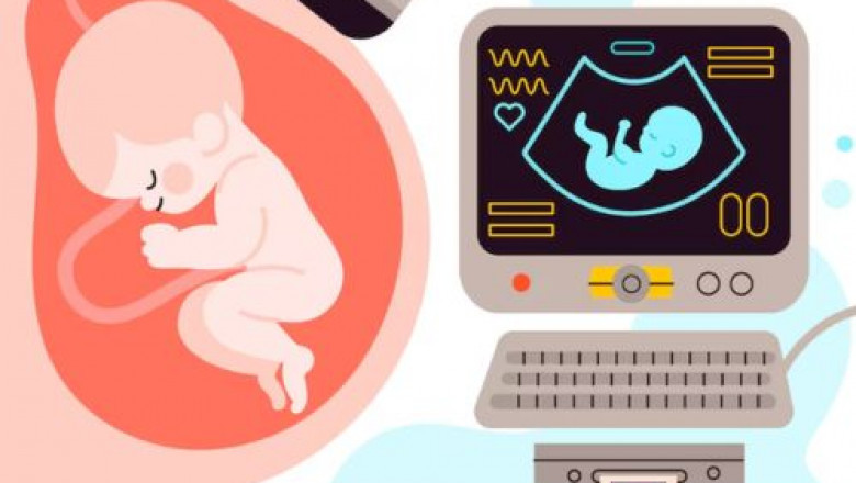 Modern Ultrasound Facilities for Pregnancy Monitoring