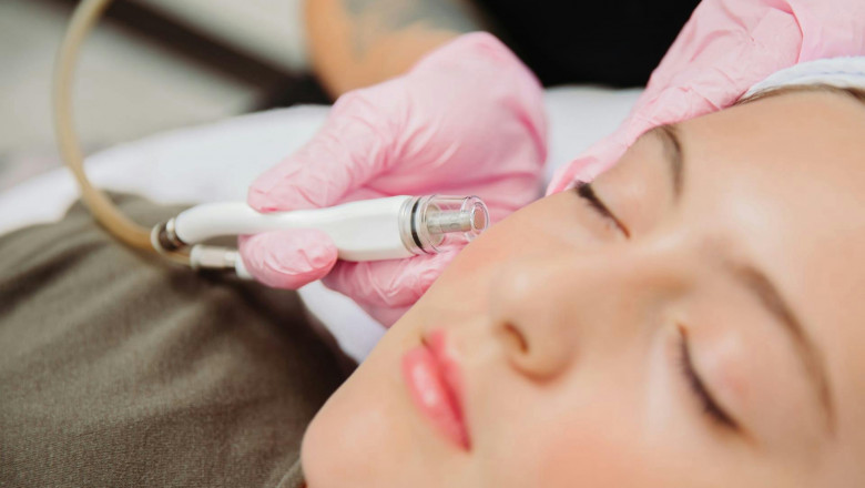 Breakout-Proof Your Skin With Expert Acne Treatment Advice