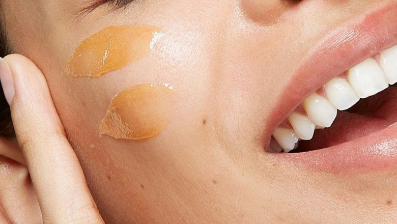 Chemical Peels for Bright, Even Skin Tone
