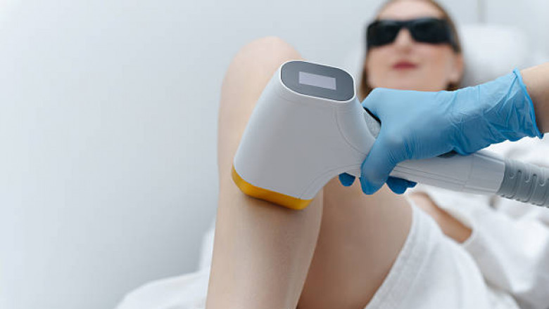 Discover Smooth Skin: The Rise of Laser Hair Removal in Toronto