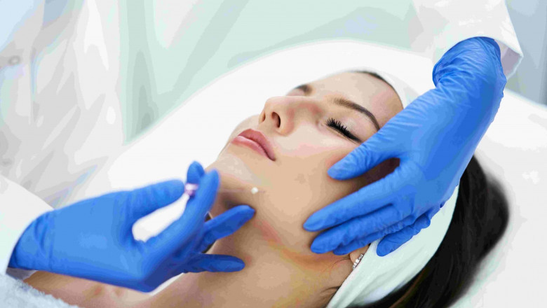 Top Myths About Thread Lifts Debunked by the Best Plastic Surgeon in Dubai