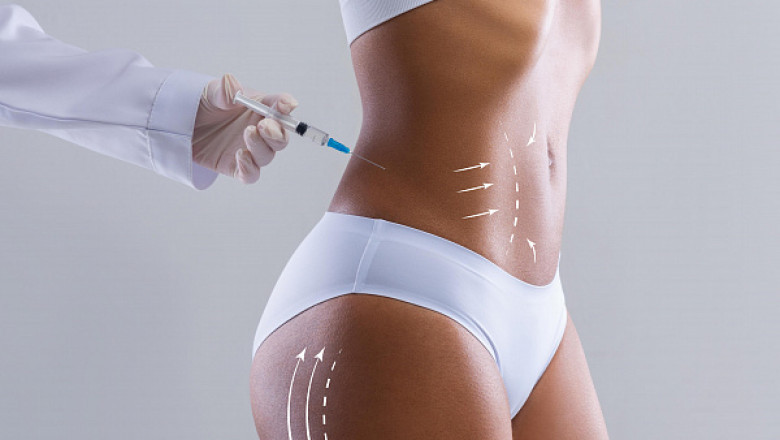 Fat Dissolving Injection for Belly Fat Control