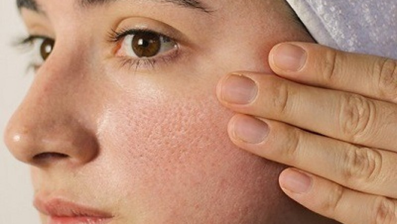 How Dubai Residents Are Reducing Large Pores