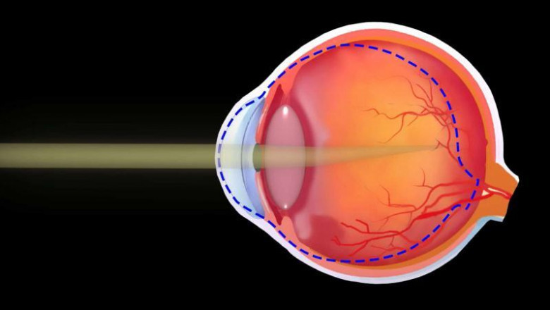 Presbyopia Treatment Market Set to Expand Driven by Rising Aging Population
