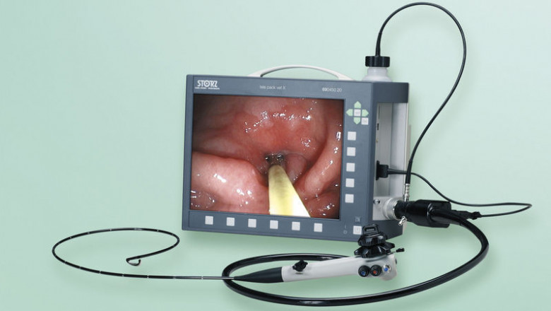 Veterinary Endoscope Market Sees Boost from Growing Veterinary Infrastructure and Specialized Animal Clinics