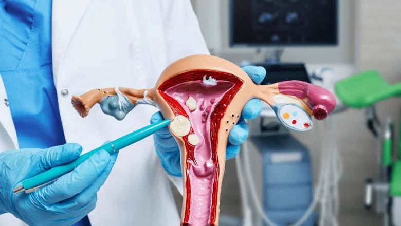 How to Choose the Best Gynecologist in Guwahati for Your Health Needs