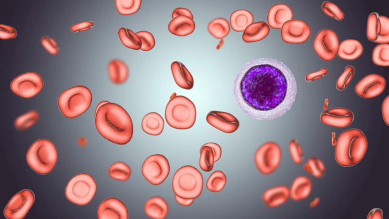 Warm Autoimmune Hemolytic Anemia Market Projected to Expand with Advanced Therapies
