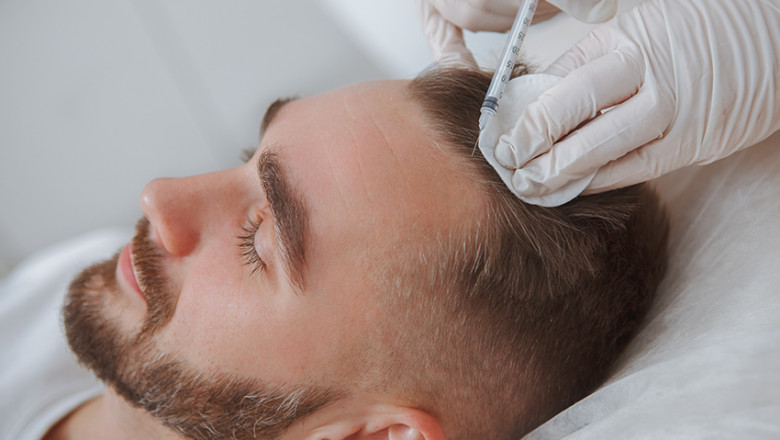 Hair Restoration Market: Future Outlook for Stem Cell and Regenerative Therapies