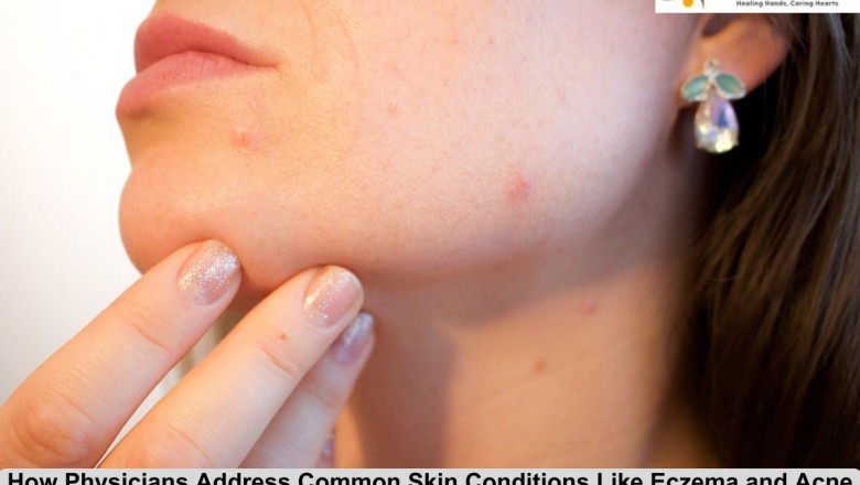 How Physicians Address Common Skin Conditions Like Eczema and Acne