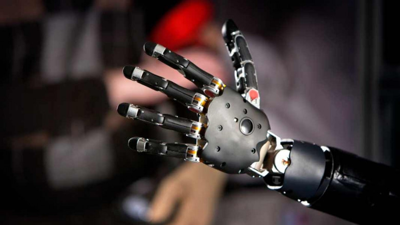 Robotic Prosthetics Market Growth: Size, Trends, Analysis
