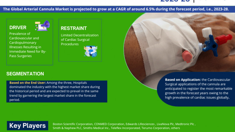 Arterial Cannula Market Poised for Strong 6.5% CAGR Through 2028 | Size &amp; Opportunity Insights