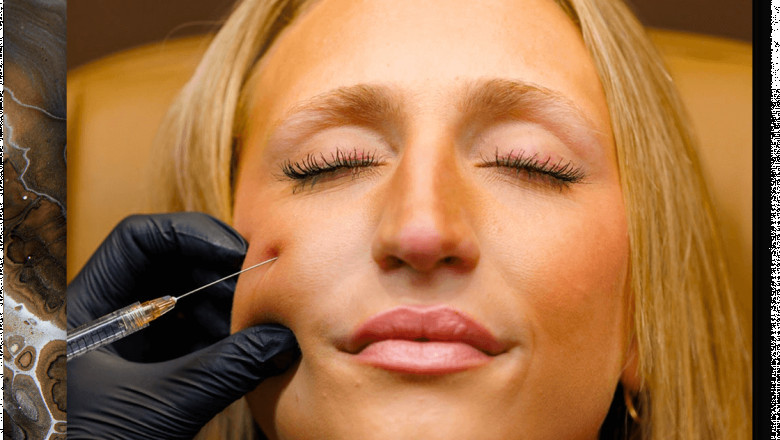 Care and Exceptional Results Combined at BARE Aesthetics