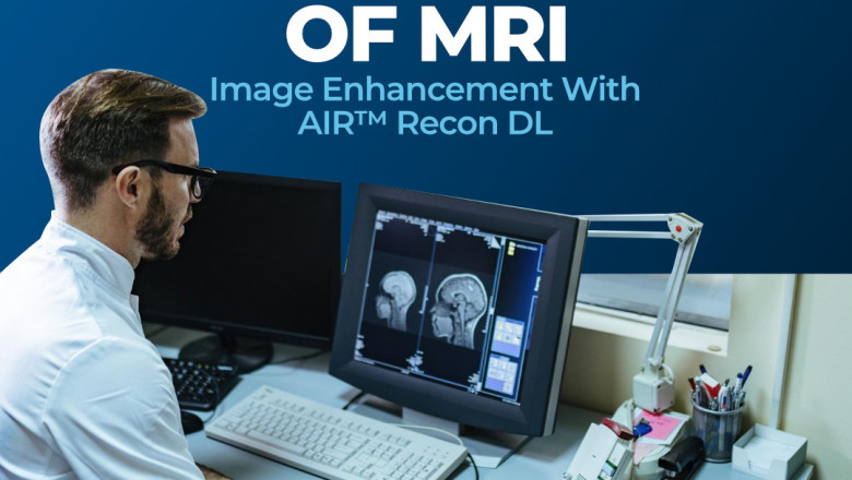 Precision in Every Scan: Discover Why Elite Scan Centre is the Best Scanning Center in Thrissur