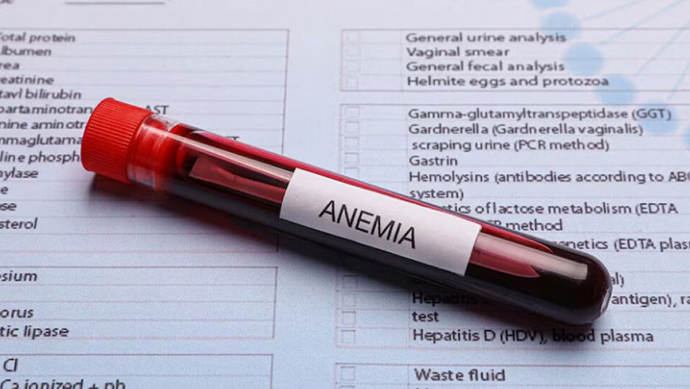 Tips to Tackle Anaemia