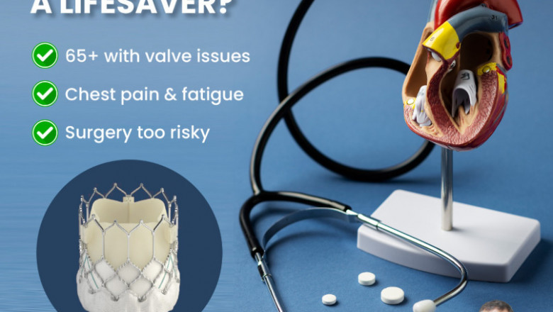Aortic Valve Implantation in Delhi: The Definitive Guide to Life-Saving Care