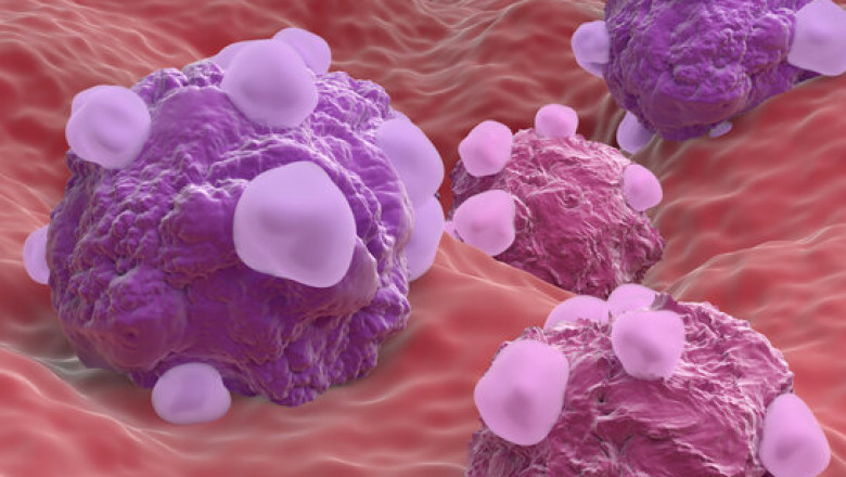 Clear Cell Ovarian Cancer Market Growth and Trends Analysis