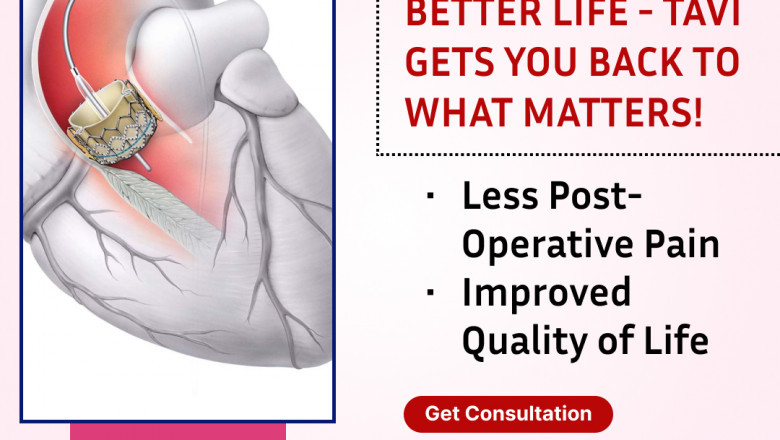 Dr. Srinivasa Prasad BV | TAVI in Bangalore