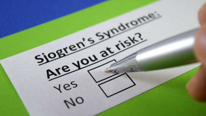 Sjogren’s Syndrome (SS): Implications in Oral Health