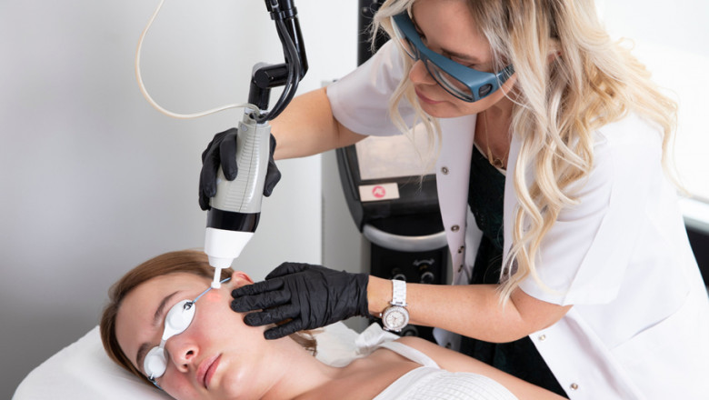 Fractional CO2 Laser Treatment in UAE: FAQs Answered