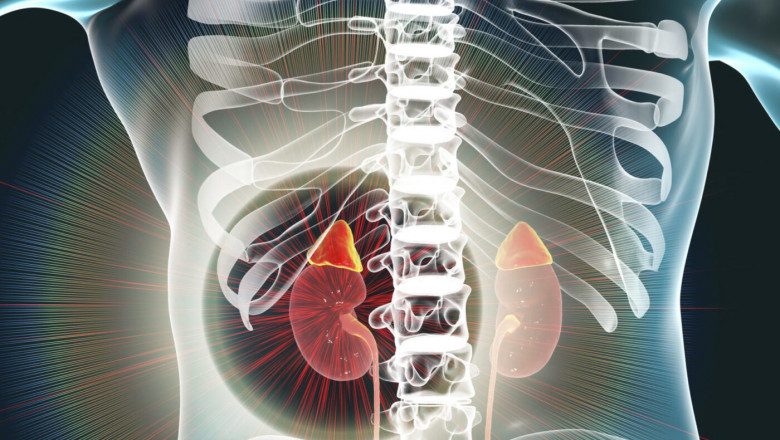 Pheochromocytoma Treatment Market Growth and Opportunities Ahead