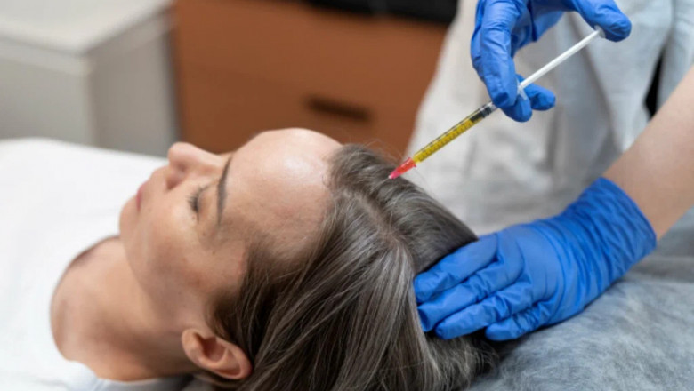 PRP in Islamabad for Stretch Marks and Body Scars