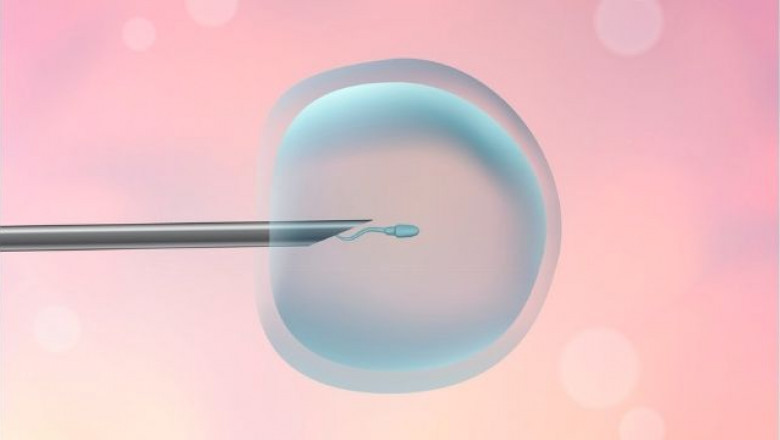 Best ICSI Treatment in Hyderabad, Gachibowli – Dr. Sravya Buggana