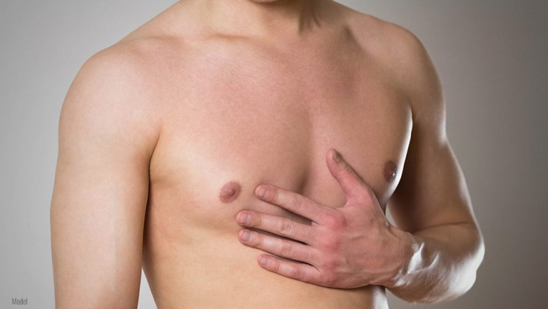 Can Supplements Really Help Reduce Gynecomastia