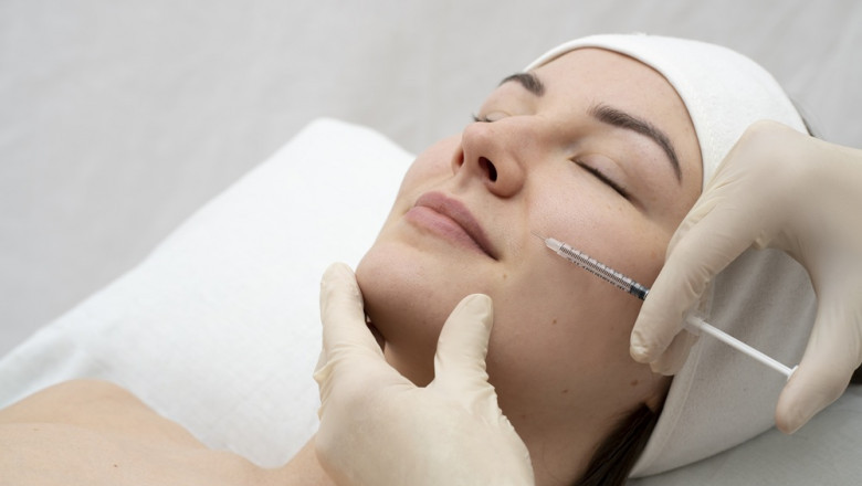 Expert Dermal Fillers in Whangaparaoa — Only at Skin Renew