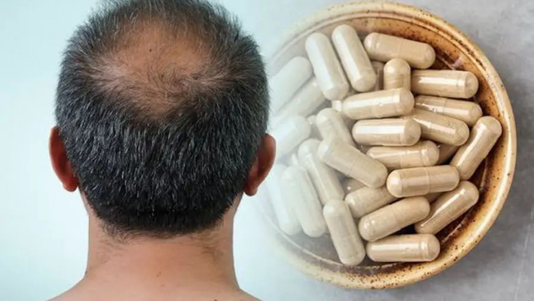 Hair Growth Supplements Market: Size, Trends, and Strategic Growth Outlook 2025-2032