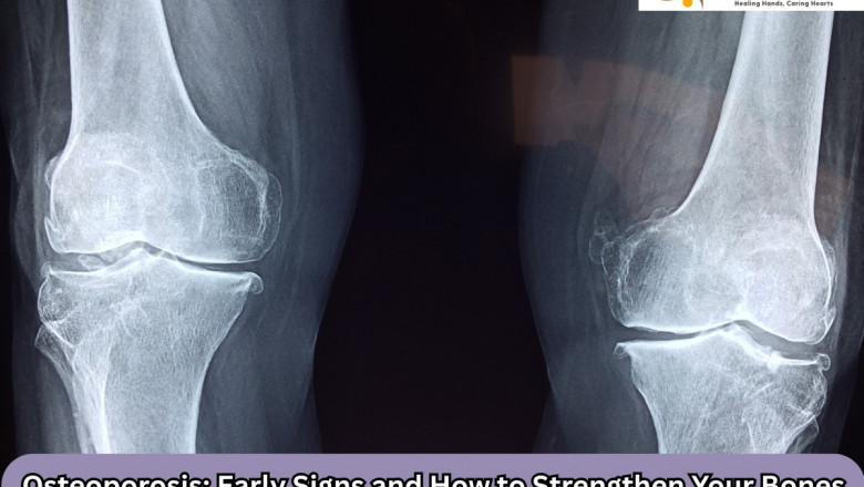 Osteoporosis: Early Signs and How to Strengthen Your Bones