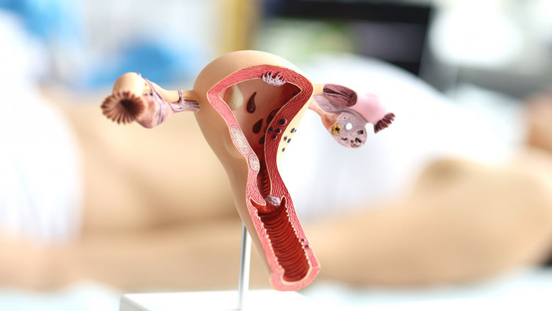 The Importance of Early Detection with Pap Smear in Dubai