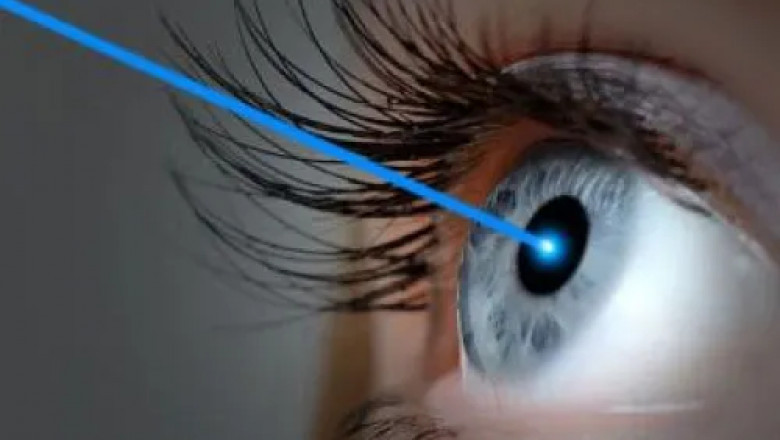 Understanding The Real Contoura Vision Cost In Delhi