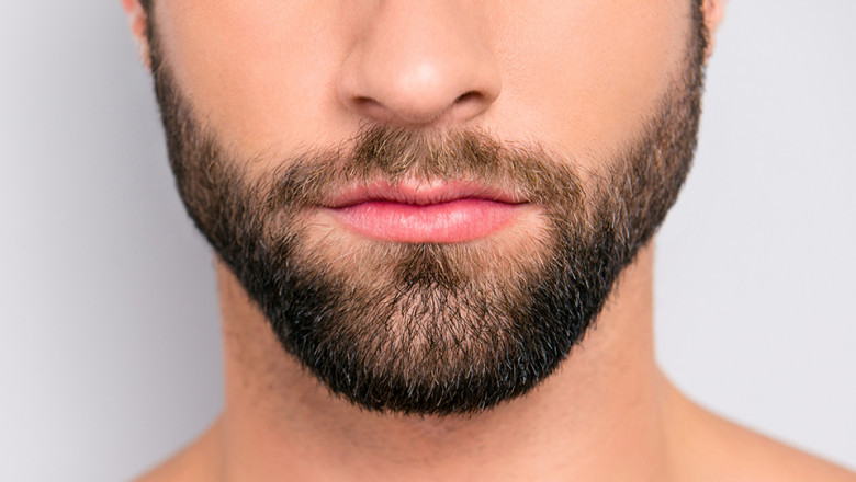 Beard Hair Transplant in UAE: Latest Innovations