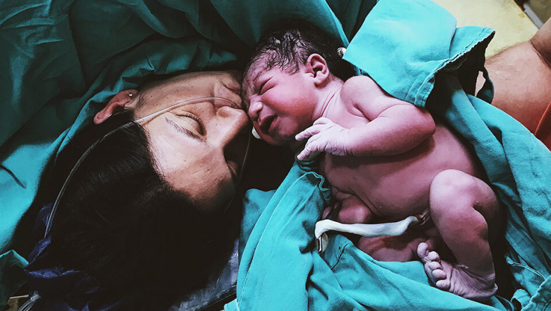 C-section vs. Natural Delivery – What to keep in mind for a safe birthing experience