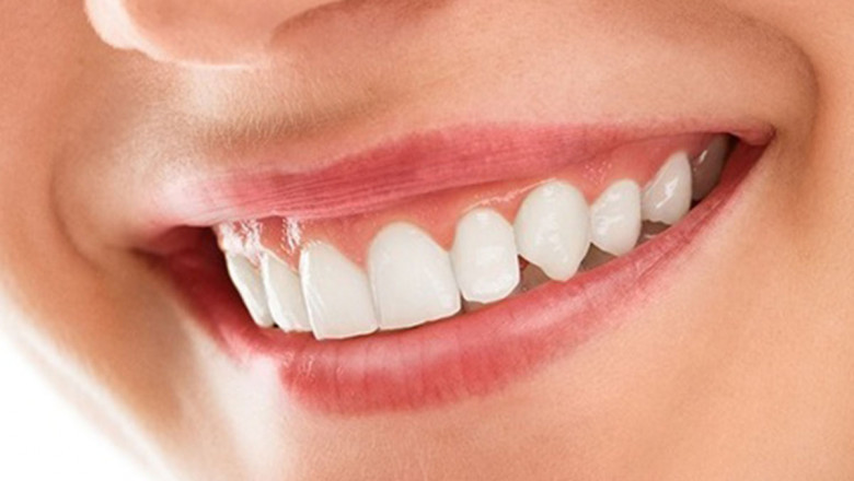 Good cosmetic dentistry in faridabad | Good cosmetic dentistry in faridabad