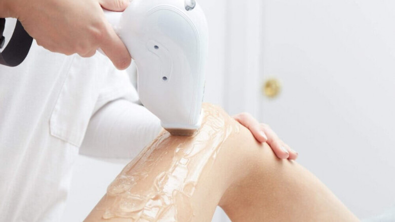 Pairing Laser Hair Removal with Chemical Peels in Islamabad