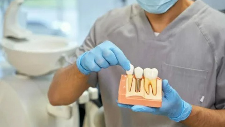 Restore Your Smile with Dental Implants NYC